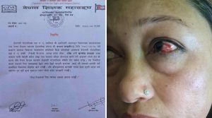 सिन्धुपाल्चोकमा प्रधानाध्यापक कुट्ने विद्यालय व्यवस्थापन समिति अध्यक्षविरुद्ध जाहेरी दर्ता